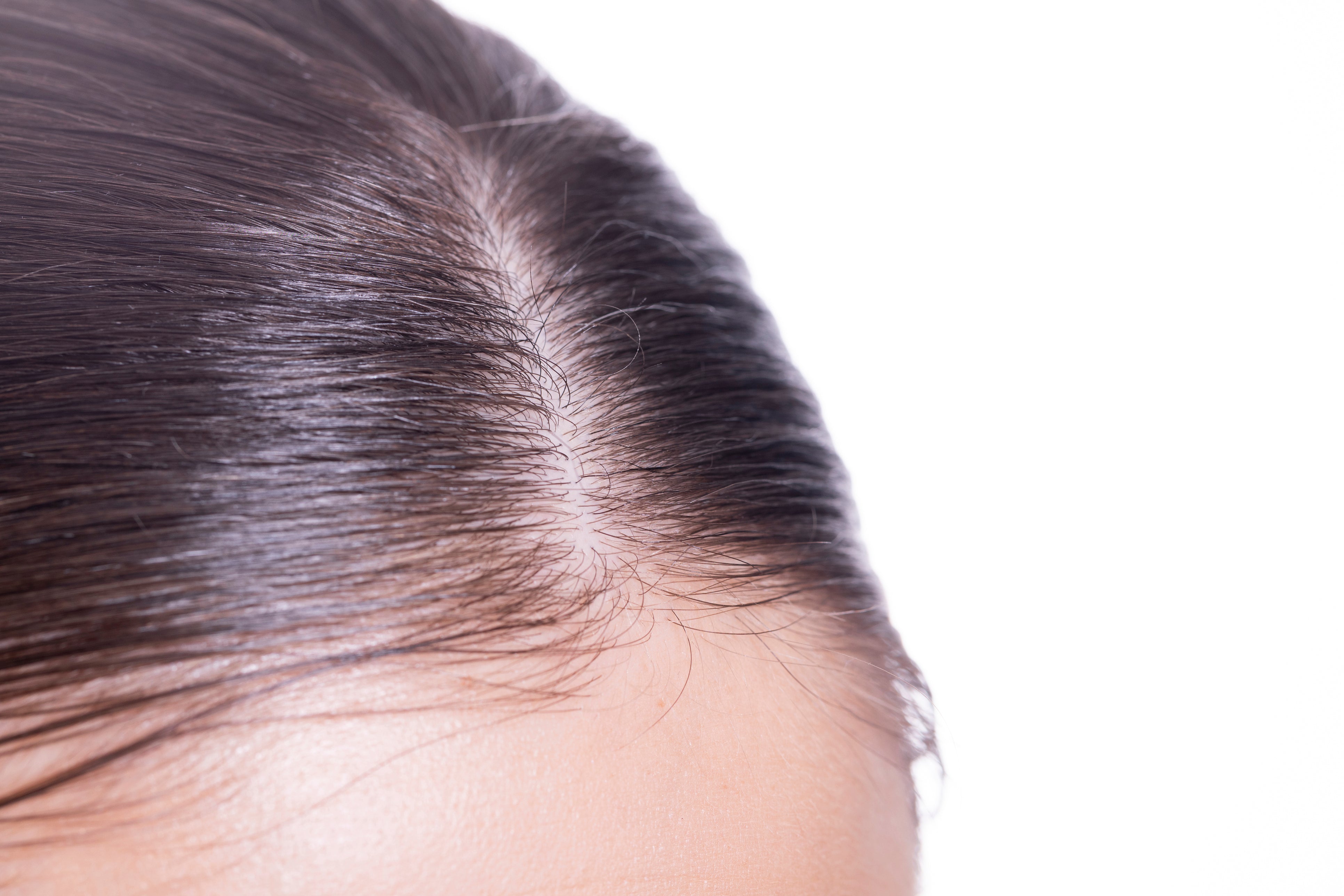 Scalp Health & Hair Restoration Bundle - 2-month supply